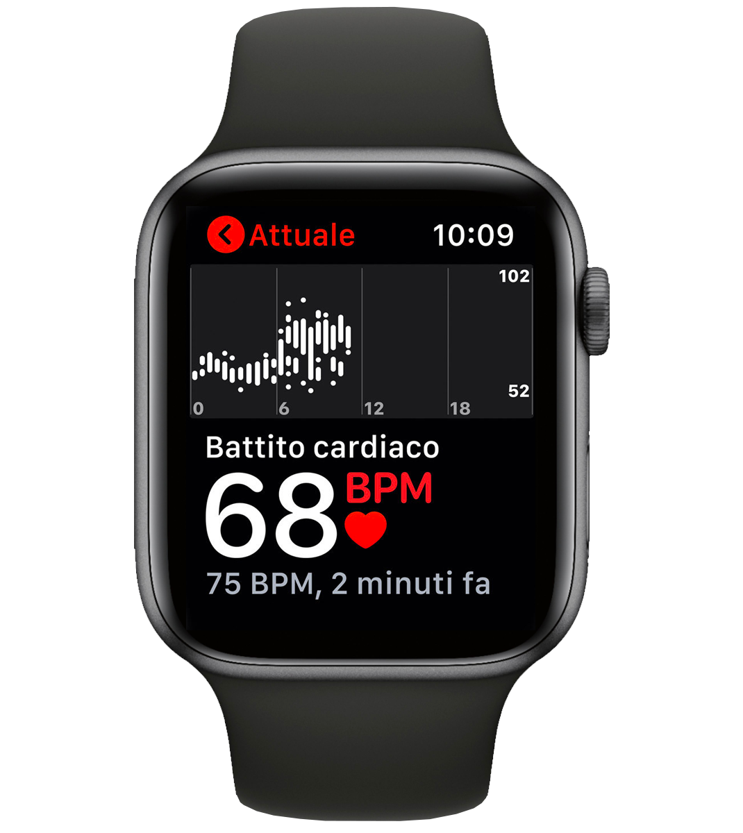 ECG Apple Watch immagine elettriocardiogramma